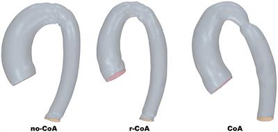 Isolating the Effect of Arch Architecture on Aortic Hemodynamics Late After Coarctation Repair: A Computational Study